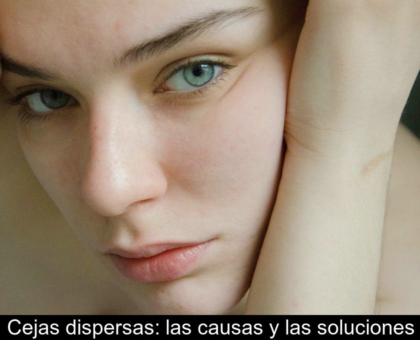 Cejas Dispersas: Las Causas Y Las Soluciones